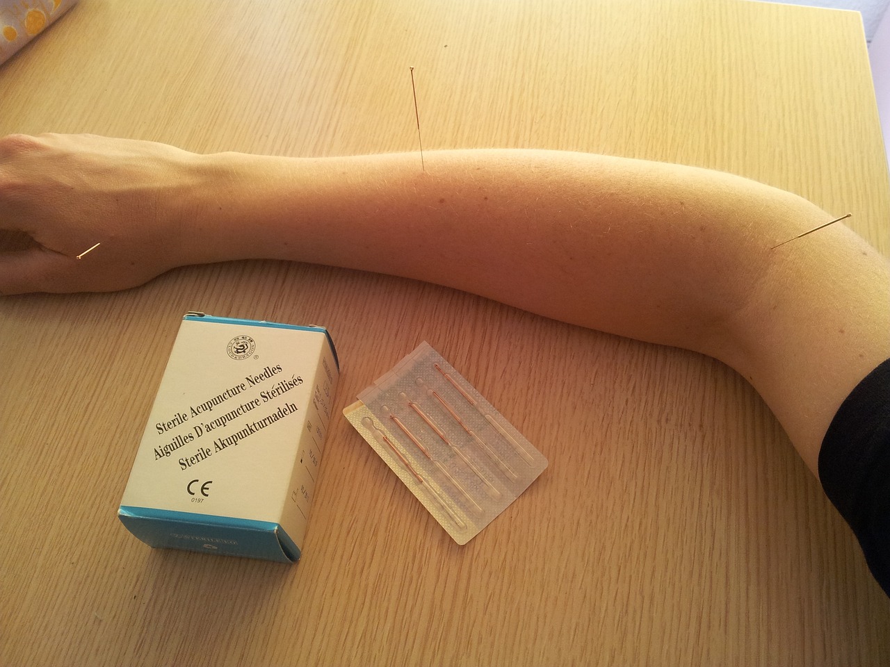 Jak przygotować się do zabiegu fizjoterapeutycznego?